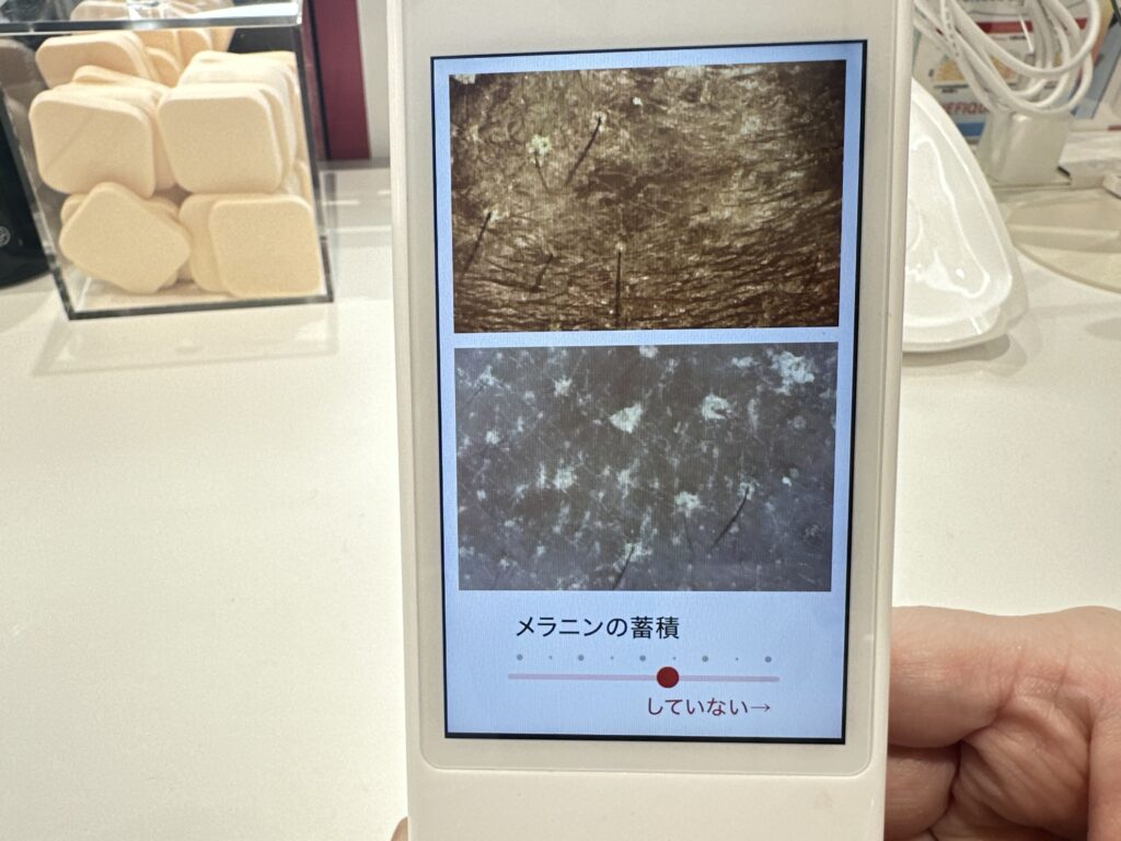 @cosme NAGOYA アットコスメナゴヤ 現在の肌状態 メラニンの蓄積