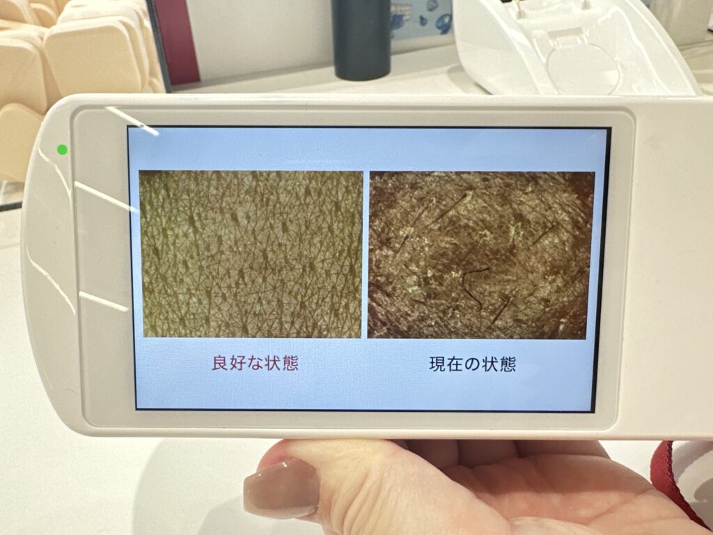 @cosme NAGOYA アットコスメ名古屋　肌診断